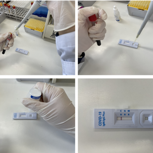 코로나19 항체검사기관 지정 및  COVID-19 항체검사 실시